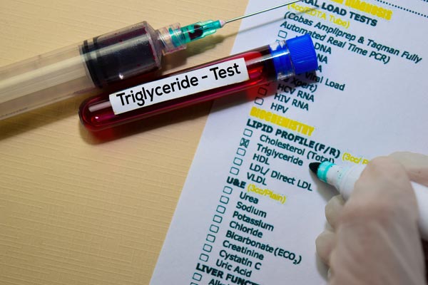 Ein weiterer Begriff, der in Zusammenhang mit dem Cholesterinspiegel fällt ist: Triglyceride.